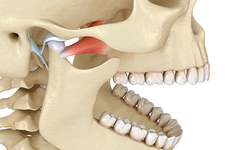 Disfunção da articulação temporomandibular (ATM).